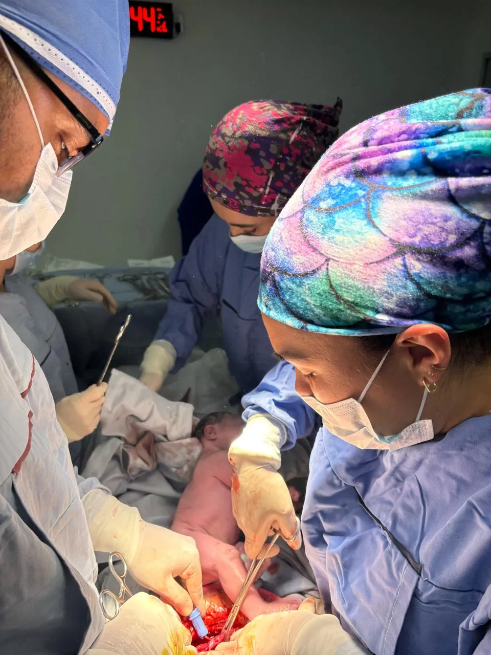 Equipo médico atendiendo el nacimiento de un bebé por cesárea